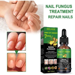 Nail Repair Solution