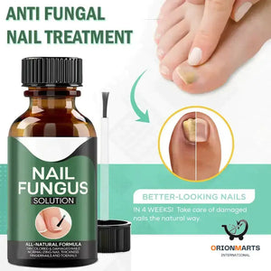 Anti-Fungal Nail Treatment